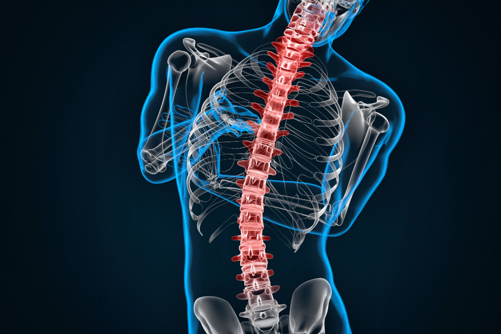 Spinal Disorders Treated in Bryant Park, NYC & Tuckahoe